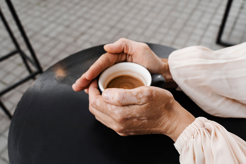 Alzheimer Café: collaborazione tra Punto Alzheimer, AVULSS e AUSER